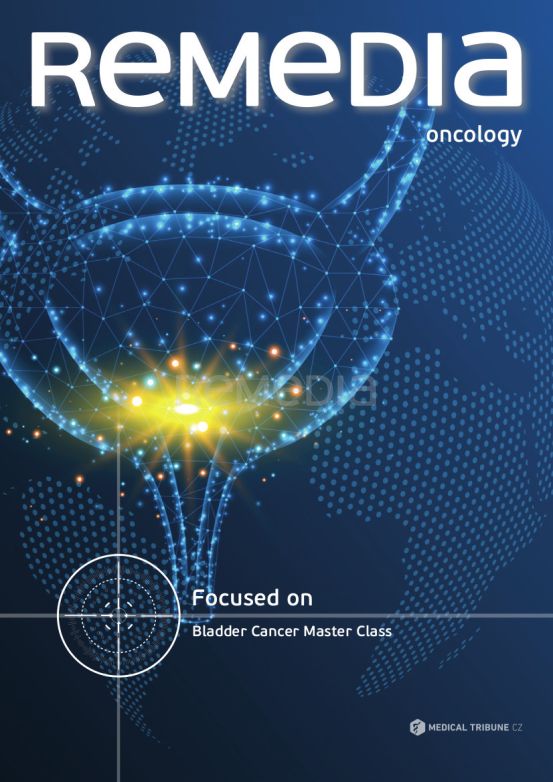 Bladder cancer eng Bladder cancer eng