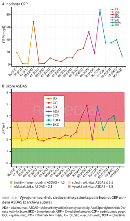 GRAF 1A, B&nbsp;Vývoj onemocnění u&nbsp;sledovaného pacienta podle&nbsp;hodnot CRP a&nbsp;indexu