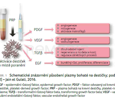 OBR. 1 Schematické znázornění působení plazmy bohaté na&nbsp;destičky