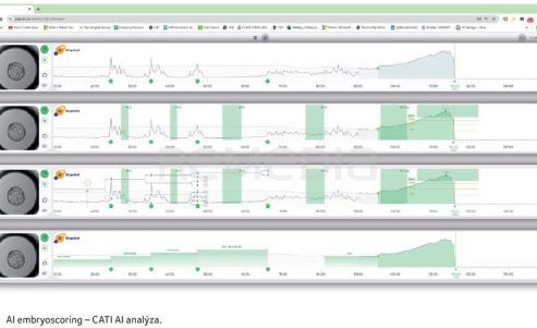 OBR. 1A AI embryoscoring – CATI AI analýza.