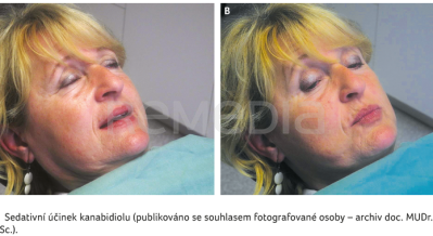 OBR. 2A, B&nbsp;Sedativní účinek kanabidiolu