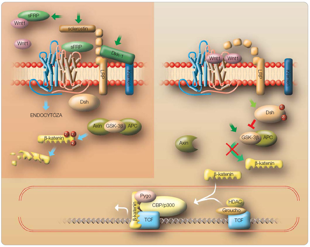  Obr. 1  Kanonická signální cesta Wnt. Vlevo: inaktivní stav, kdy je b-katenin fosforylován a degradován. Vpravo: vytvoření komplexu Wnt-Frizzled-LRP5/6, inhibice GSK-3b a vstup nefosforylovaného b-kateninu do jádra umožní expresi cílových genů. Tmavozelené šipky označují hlavní molekulární cíle pro osteoanabolickou léčbu. Bližší charakteristika jednotlivých komponent kaskády viz text. 