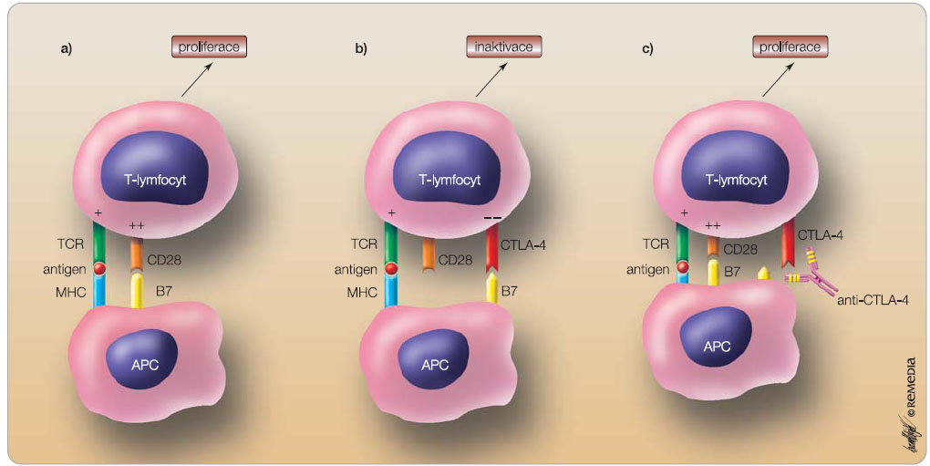 Obr. 2  Aktivace T-buněk a mechanismus působení terapie využívající anti-CTLA-4 protilátek: 