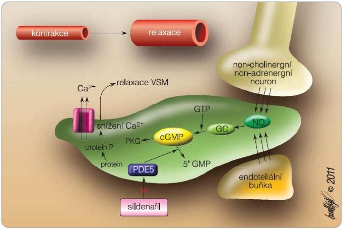 Obr. 1  Mechanismus účinku sildenafilu; podle [2] – Kukreja, et al., 2005NO – oxid dusnatý, GC – guanylát cykláza, GTP – guanosin trifosfát, cGMP – cyklický guanosin monofosfát, PKG – proteinkináza G, PDE5 – fosfodiesteráza typu 5, GMP – guanosin monofosfát, VSM – vaskulární hladký sval (vascular smooth muscle) 