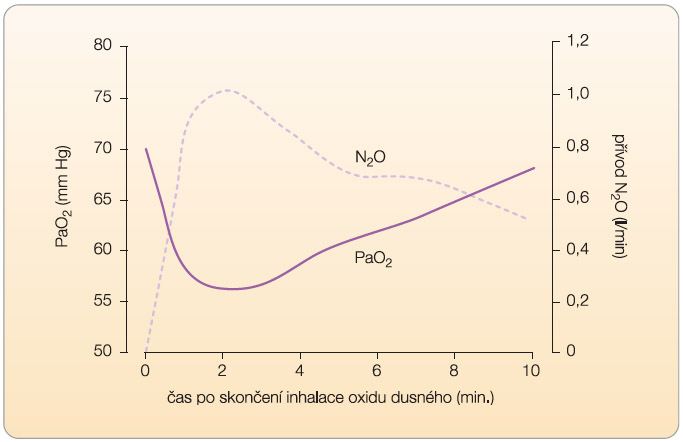 Graf 2  Po inhalaci oxidu dusného může dojít k difuzní hypoxii, při které klesá parciální tlak kyslíku v alveolech (PaO2) a zároveň stoupá koncentrace oxidu dusného; podle [23] – Craig, Skelly, 2004.
