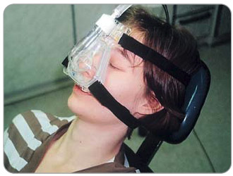Obr. 10  Sedace oxidem dusným směsí 50 % N2O/50 % O2 nosní maskou před stomatologickým výkonem. Fotografie je publikována se souhlasem autora.