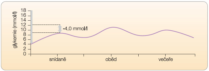 Graf 5 Po snížení glykemie nalačno se sníží při pravidelném režimu celodenní glykemický profil a výsledkem je také snížení absolutní hodnoty postprandiální glykemie. Rozdíl mezi glykemií nalačno a postprandiálně se ale nemění. Znázorněno jako schematický glykemický profil.