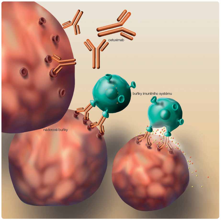 Obr. 1 Vazba cetuximabu na nádorovou buňku s aktivací imunitního systému proti nádoru (ADCC – na protilátkách závislá buněčná cytotoxicita).