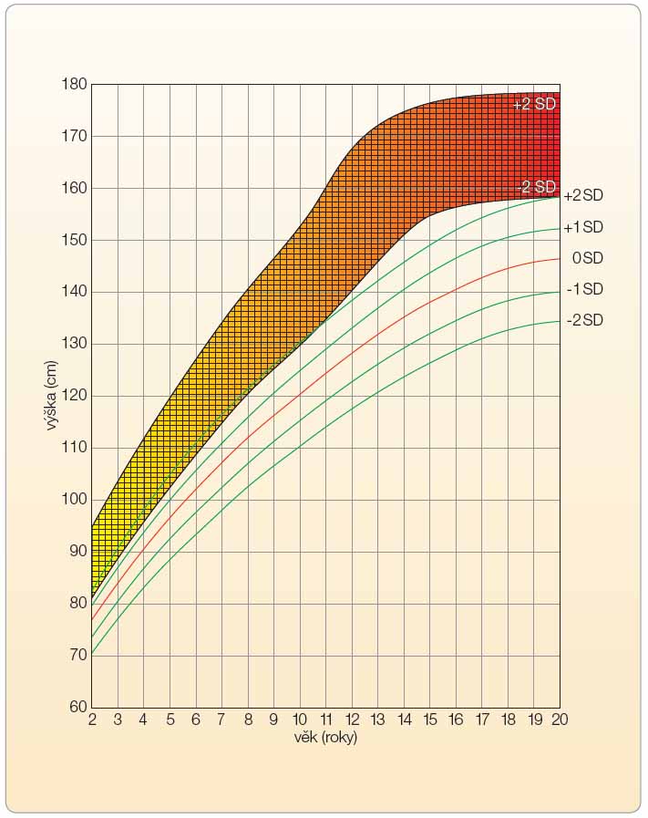 Graf 1 Percentilový graf tělesné výšky neléčených pacientek s TS ve věku od 2 do 20 let. Tmavá plocha představuje fyziologické rozmezí tělesné výšky zdravých děvčat (upraveno podle [5] – Ranke, et al., 1991).