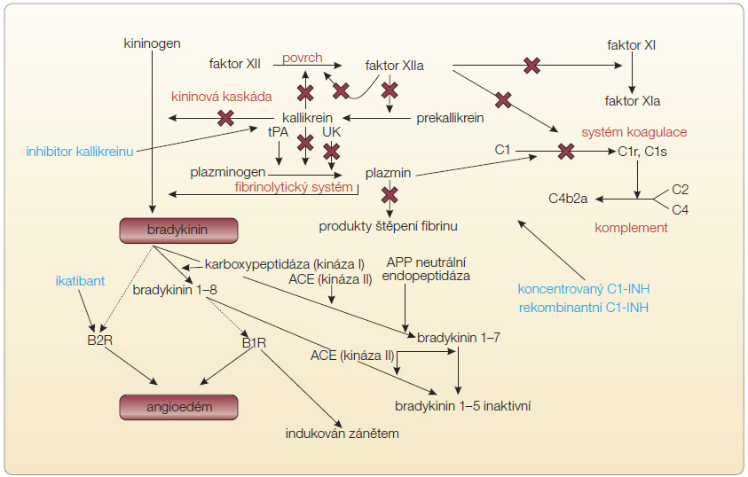 Obr. 2 Vztahy mezi aktivací plazmatických kaskádových systémů a C1 inhibitoru, volně podle [4] – Caballero, et.al., 2011.  – místa inhibice C1-INH; ACE – angiotenzin konvertující enzym; APP – protein akutní fáze; B1R – bradykininový receptor 1; B2R – bradykininový receptor 2; C1-INH – C1 inhibitor; tPA – tkáňový plazminogenový aktivátor; UK – urokináza