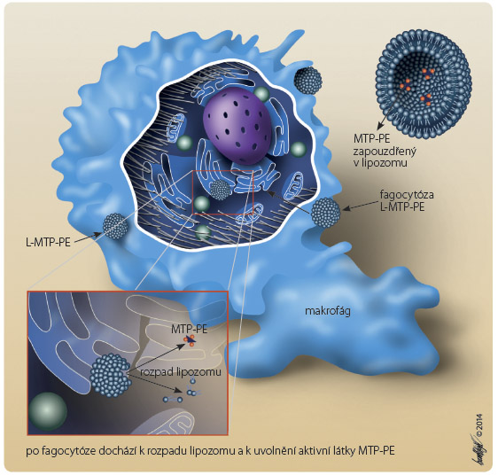  Obr. 2 Mifamurtid v lipozomální lékové formě aktivuje monocyty a makrofágy především v játrech, slezině a plicích. Podává se ve formě lipozomální suspenze intravenózní infuzí v průběhu jedné hodiny.MTP-PE – muramyl tripeptid fosfatidyl ethanolamin neboli mifamurtid; L-MTP-PE – lipozomální léková forma mifamurtidu