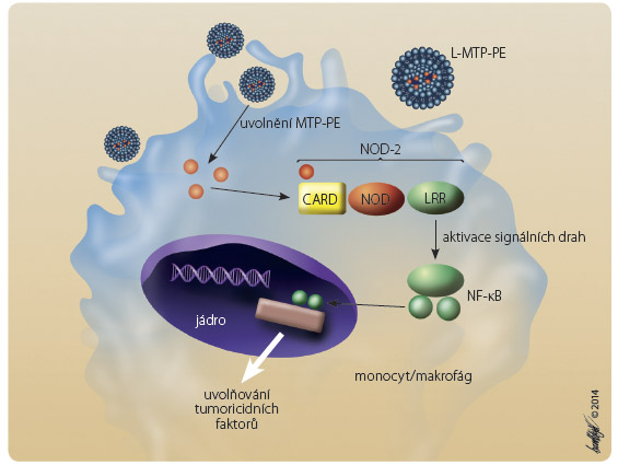 Obr. 3 Schematické znázornění mechanismu účinku mifamurtidu; volně podle [38] – Ando, et al., 2011.MTP-PE se po uvolnění do cytosolu specificky váže na intracelulární receptor NOD-2, čímž se spustí kaskáda aktivací signálních drah cestou nukleárního faktoru (NF-κB) a dochází k produkci tumoricidních látek. Tato reakce vede k likvidaci reziduálních nádorových buněk.L-MTP-PE – lipozomální léková forma mifamurtidu; MTP-PE – muramyl tripeptid fosfatidyl ethanolamin, mifamurtid; NF-κB- nukleární faktor kappa-B; NOD-2 – intracelulární receptor rozpoznávající specifické bakteriální peptidoglykany