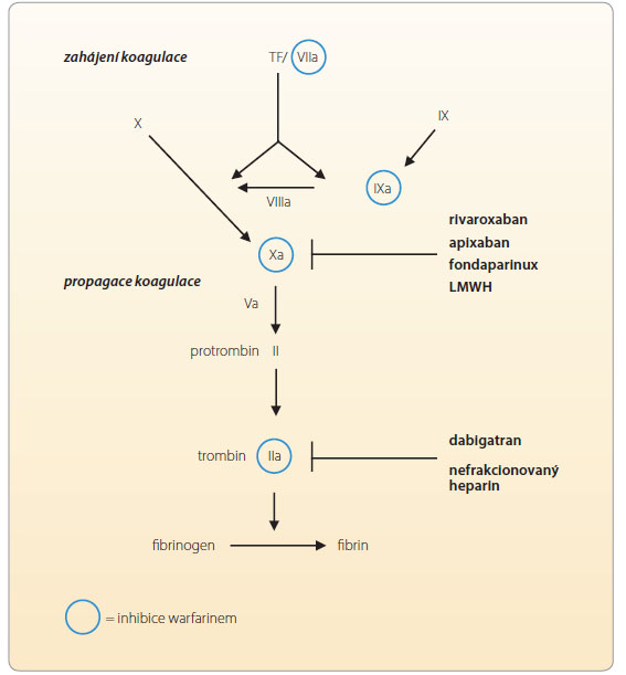  Obr. 1 Antikoagulancia a jejich zásah v koagulační kaskádě. LMWH - nízkomolekulární heparin; TF – tkáňový faktor