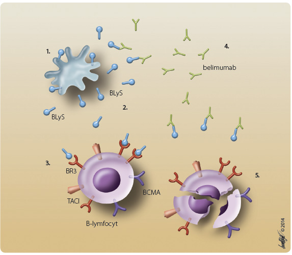  Obr. 1 Schematické znázornění mechanismu účinku belimumabu. 1. Prezentace antigenu na periferii a aktivace monocytů vede k uvolnění BlyS. 2. BLyS je za účasti dalších zánětlivých cytokinů (IL-2, IFNγ, TNFα) štěpen na solubilní proteinovou část. 3. Na povrchu B-lymfocytů je solubilní BLyS vázán třemi druhy buněčných receptorů: BR3, TACI a BCMA, z nichž nejsilnější vazbu má receptor BR3. BLyS působí jako silný aktivátor B-lymfocytů. Zvýšené hladiny BLyS přispívají k abnormálnímu vývoji B-lymfocytů. 4. Belimumab vytváří komplexy se solubilní formou BLyS. 5. Inhibicí vazby BLyS na buněčné receptory vede k supresi, snížení diferenciace, aktivace a přežívání B-lymfocytů. Belimumab inhibuje přežití B-lymfocytů, včetně autoreaktivních B-lymfocytů, a snižuje diferenciaci B-lymfocytů na plazmatické buňky produkující imunoglobuliny. BLyS – stimulátor B-lymfocytů, soluble B lymphocyte stimulator; BR3 – BLyS receptor 3; TACI – transmembránový aktivátor s modulátorem vápníku a cyklofilin ligand interaktor, transmembrane activactor and calcium modulator and cyclophilin ligand interactor; BCMA – antigen maturace B-lymfocytů, B-cell maturation antigen