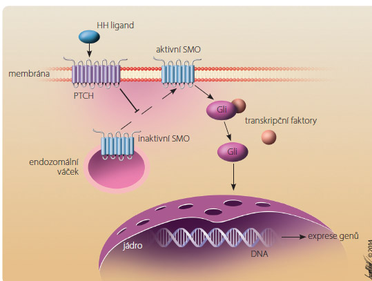 Obr. 1 Úloha signální dráhy Hedgehog v buněčné proliferaci. Transmembránový protein PTCH inhibuje protein SMO, který funguje jako přenašeč buněčným povrchem. Navázáním ligandu HH na PTCH dochází k odblokování jeho inhibičního účinku na SMO. Následná translokace SMO k buněčnému povrchu vyvolá buněčný signál – dojde k aktivaci transkripčních faktorů Gli, které se přesunou do jádra, spustí transkripci specifických genů a dochází k diferenciaci a buněčné proliferaci. Úloha vismodegibu v signální dráze HH: vismodegib inhibuje signalizaci HH vazbou na SMO – nedochází k aktivaci SMO, následný přenos signálu a exprese cílových genů jsou blokovány. DNA – deoxyribonukleová kyselina; HH – Hedgehog; PTCH – protein Patched-1; SMO – protein Smoothened