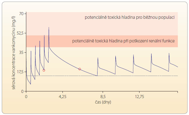 Graf 6 Ilustrace počítačem asistované simulace hladiny vankomycinu v programu MW/PHARM u staršího pacienta s rychle progredující změnou renální funkce; podle [12] – Tesfaye, et al., 2012. Záznam znázorňuje, jak lze v programu MW/PHARM na základě pozorovaných hodnot (červené kruhy) odhadnout optimální dávkovací režim.