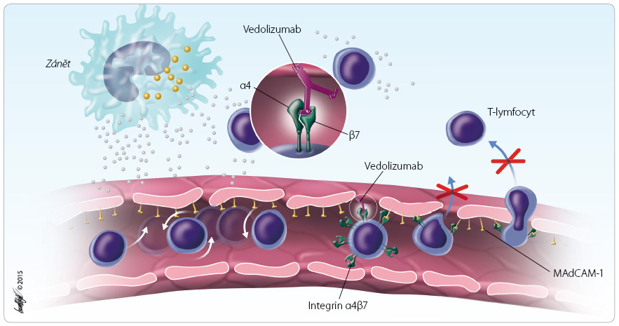 Obr. 1 Mechanismus účinku vedolizumabu. Vedolizumab je monoklonální protilátka typu IgG1, která vazbou na integrinový receptor α4β7 blokuje jeho interakci s adhezní molekulou MAdCAM-1. Tím je inhibován přestup T-lymfocytů z krevního řečiště, které preferenčně migrují do zánětlivé tkáně střev. MAdCAM-1 – mucosal vascular addressin cell adhesion molecule 1