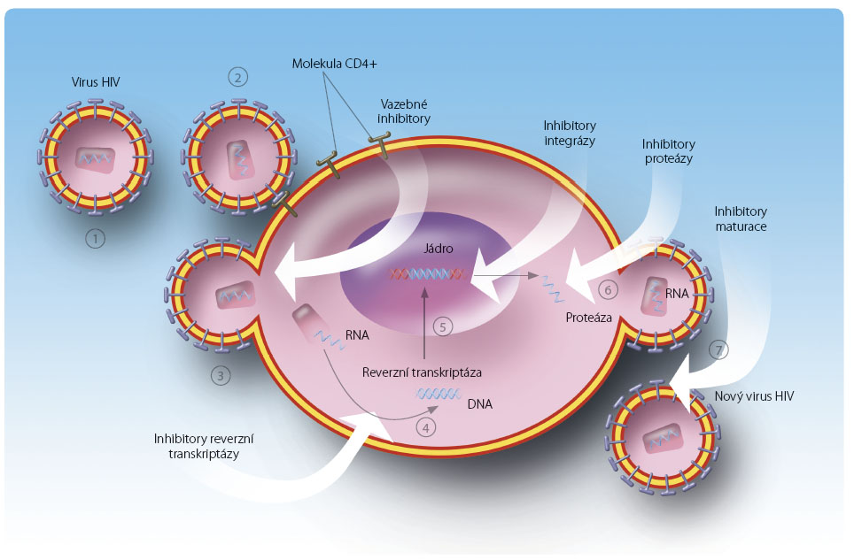 Obr. 1 Replikační cyklus viru HIV s vyznačenými místy terapeutického působení. 1 – volný virus HIV; 2 – vazba a fúze: virus se váže k CD4+ molekule a fúzuje s ní; 3 – infekce: virus penetruje do hostitelské buňky a vyprázdní svůj obsah; 4 – reverzní transkripce: jednovláknová virová RNA je konvertována na dvouvláknovou DNA enzymem reverzní transkriptázou; 5 – integrace: virová DNA je enzymem integrázou začleněna do vlastní buněčné DNA; 6 – transkripce: při dělení infi kované buňky je virová DNA „čtena“ a syntetizují se proteiny, jejichž řetězce se spojují; 7 – zrání: nezralá virová částice se osamostatňuje a dozrává