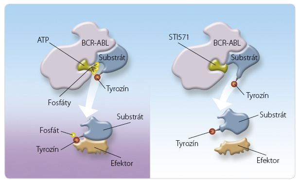 Obr. 1 Mechanizmus účinku inhibítora tyrozínkinázy (STI571) ako kompetitívneho inhibítora kinázy Bcr-Abl1 nahradením adenozíntrifosfátu (ATP); podľa [7] – Druker, et al., 2001.