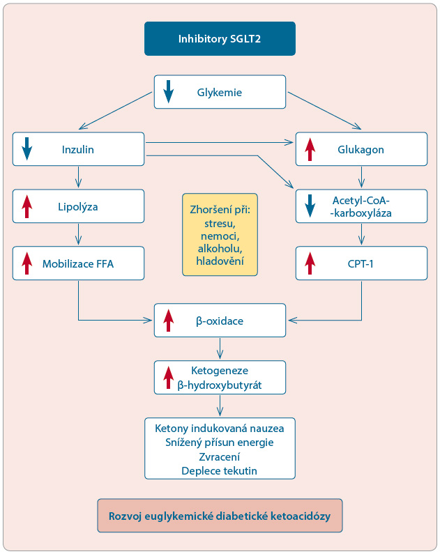 Obr. 1 Schéma rozvoje euglykemické diabetické ketoacidózy při terapii glifl oziny; podle [29] – Ogawa, et al., 2015. FFA – free fatty acids, volné mastné kyseliny; CPT-1 – karnitinpalmitoyltransferáza; SGLT2 – sodium- -glucose cotransporter 2