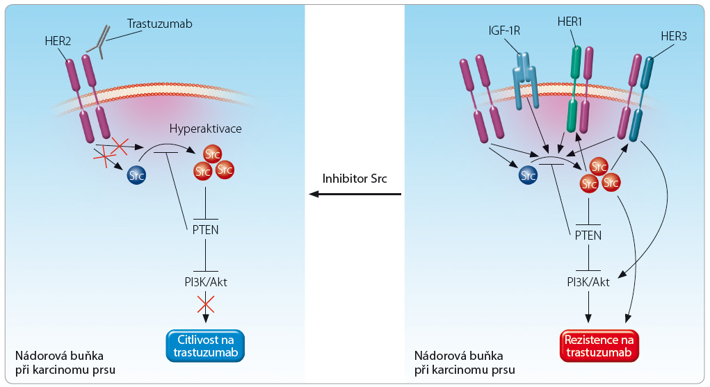 Obr. 1 Rozvoj rezistence na trastuzumab; podle [34] – Muthuswamy, 2011. HER1–3 – human epidermal growth factor receptor 1–3, receptor pro lidský epidermální růstový faktor typu 1–3; IGF-1R – insulin-like growth factor 1 receptor, receptor pro inzulinu podobný růstový faktor typu 1; PI3K/Akt – phosphatidylinositol 3-kinase/Akt, fosfatidylinositol-3-kináza; PTEN – phosphatase and tensin homolog, lipidová fosfatáza; Src – sarcoma, sarkom