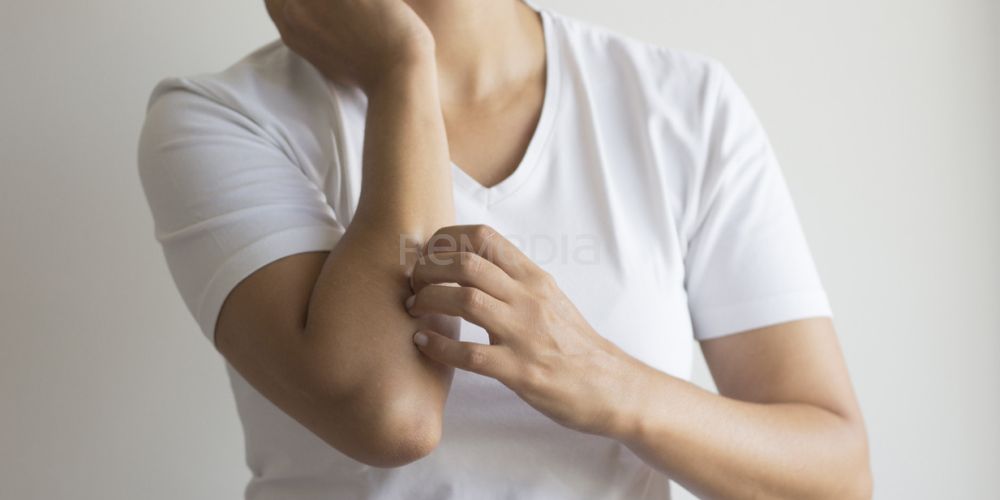 Schválena první lokální genová terapie pro dystrofickou epidermolysis bullosa