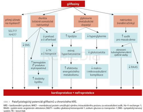 Chronický kardiorenální syndrom a glifloziny – pohled kardiologa