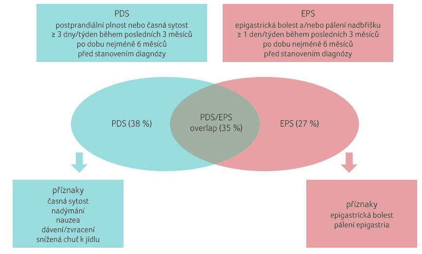 OBR. 2 Římská kritéria pro funkční dyspepsii; podle [14] – Harer, Hasler, 2020. U funkční dyspepsie je přítomen: ≥ 1 příznak postprandiální plnosti, časné sytosti, epigastrické bolesti nebo pálení, nejsou přítomny známky organického onemocnění. EPS – syndrom epigastrické bolesti, epigastric pain syndrome; PDS – postprandiální pocit sytosti, postprandial distress syndrome