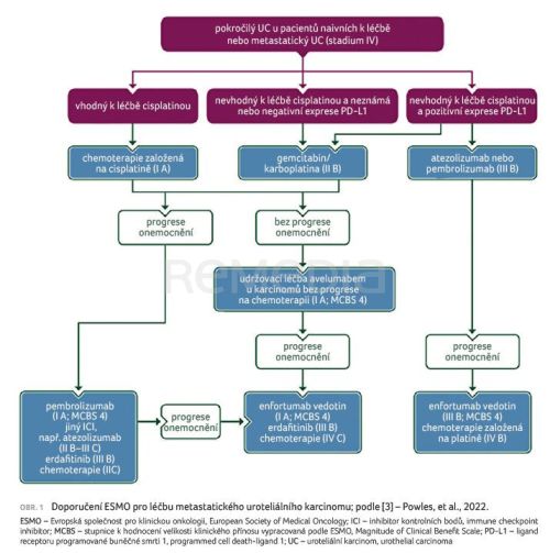 Avelumab v udržovací léčbě pokročilého karcinomu močového měchýře