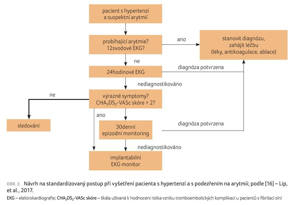 OBR. 3 Návrh na standardizovaný postup při vyšetření pacienta s hypertenzí a s podezřením na arytmii; podle [16] – Lip, et al., 2017.
