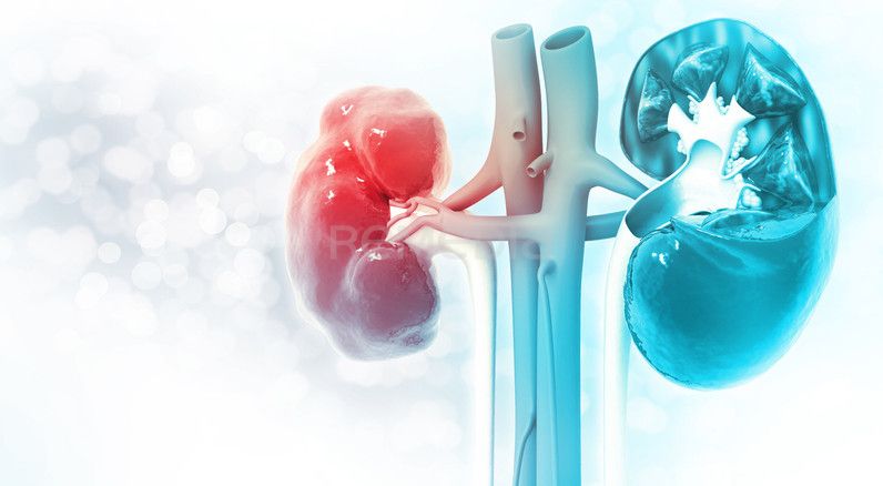 Dapagliflozin před kardiochirurgickým výkonem – prevence akutního poškození ledvin? Studie MERCURI-2