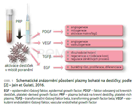 Biologický a farmakologický přínos autologní plazmy bohaté na krevní destičky s exozomy v léčbě ortopedických onemocnění