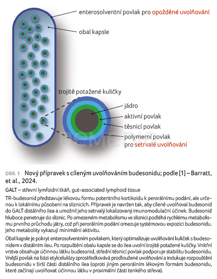 Budesonid s cíleným uvolňováním v léčbě IgA nefropatie
