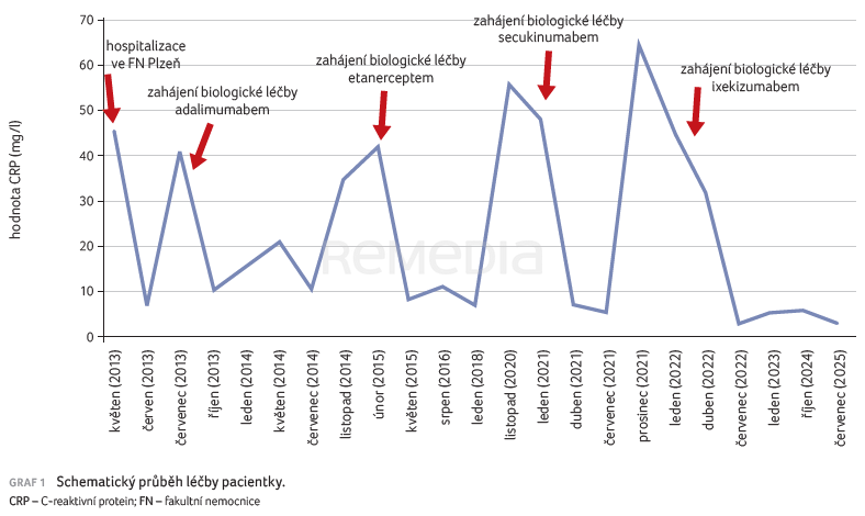 Obtížně ovlivnitelná psoriatická artritida – kazuistika