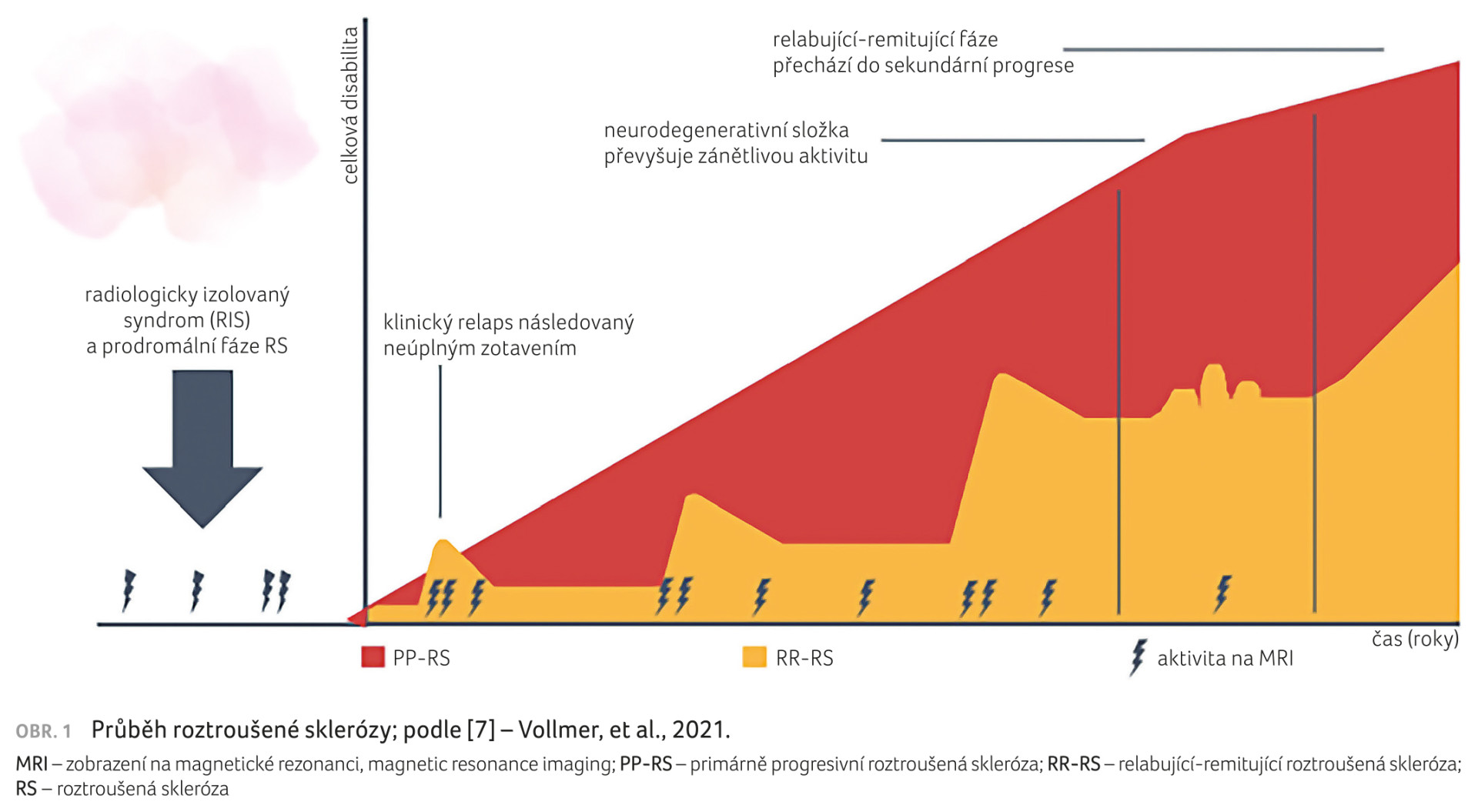 OBR. 1 Průběh roztroušené sklerózy; podle [7] – Vollmer, et al., 2021.