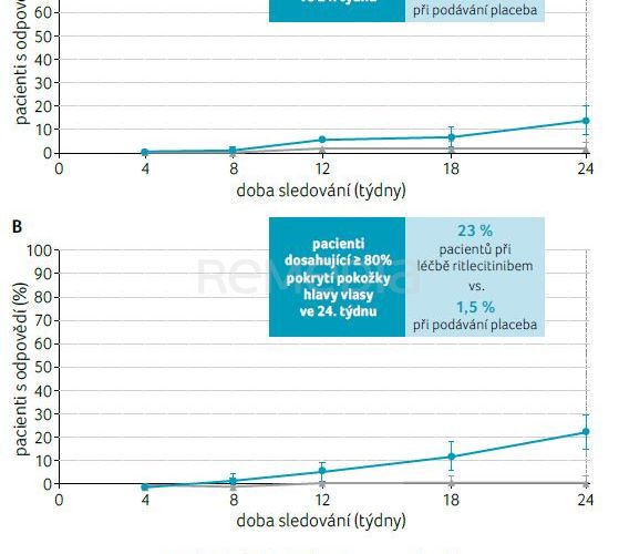 Budoucnost léčby alopecia areata