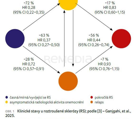 Držíme krok s vývojem roztroušené sklerózy: Používáme anti CD20 protilátky dostatečně brzy?
