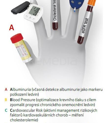 Aktuální pohled na transplantace ledvin: Které pacienty ohrožuje selhání ledvin a jaké máme nové možnosti prevence?
