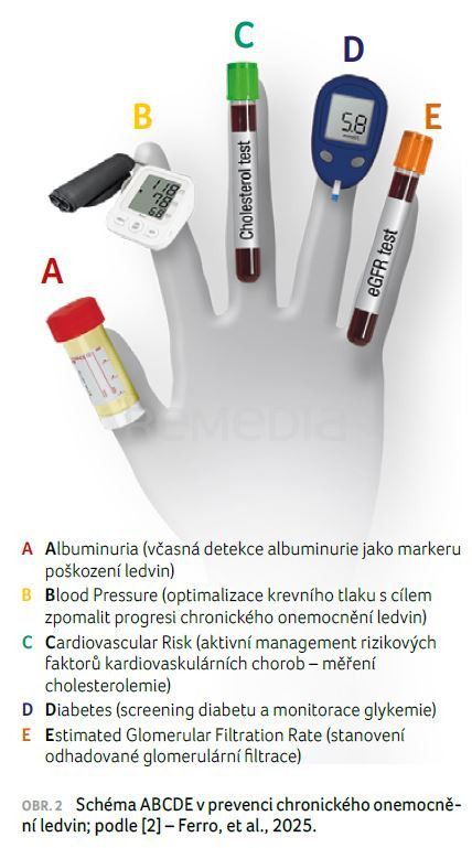 Aktuální pohled na transplantace ledvin: Které pacienty ohrožuje selhání ledvin a jaké máme nové možnosti prevence?