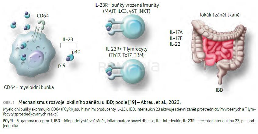 Navigace ve světě IL 23 – posunutí hranic v léčbě idiopatických střevních zánětů