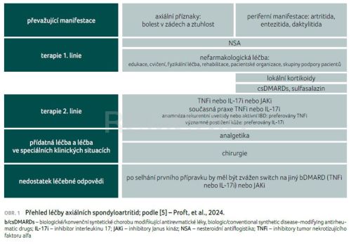 Spondyloartritidy pod lupou: Komorbidity, extramuskuloskeletální projevy a optimalizace léčby v dlouhodobé perspektivě