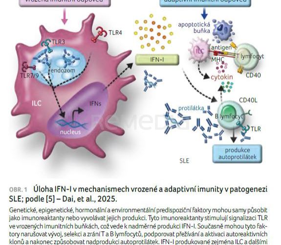 Anifrolumab v léčbě systémového lupus erythematodes