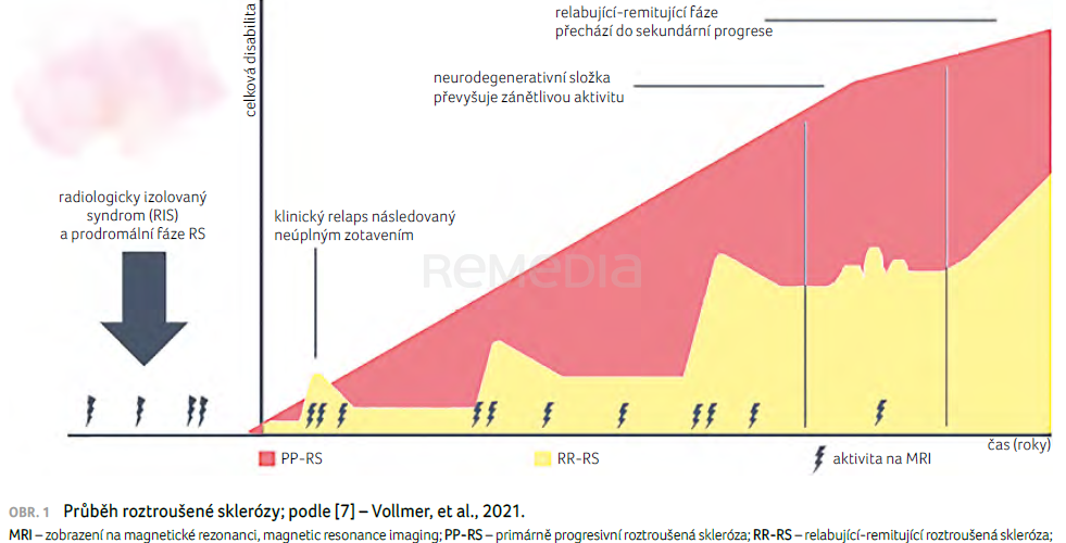 Žena a roztroušená skleróza