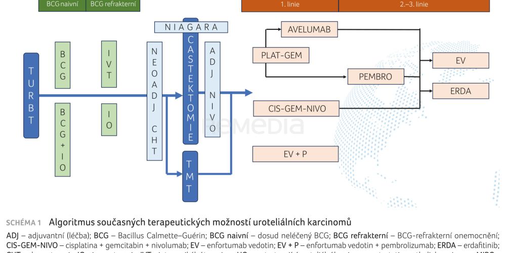 Karcinom močového měchýře v roce 2025: Kam pokročila léčba?