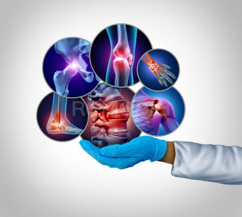 Účinnost biosimilárního přípravku SB4 a setrvání na léčbě po přechodu z léčby originálním etanerceptem