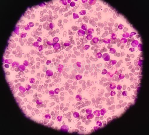 Asciminib je silným inhibitorem ABL/BCR::ABL1 tyrozinkinázy. Inhibuje aktivitu kinázy ABL1 fúzního proteinu specifickým zacílením na ABL myristoylovou kapsu. Přípravek byl registrován pro terapii dospělých pacientů s Philadelphia chromozom pozitivní chron