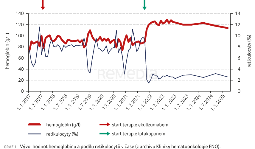 Iptakopan – další významný milník v terapii paroxysmální noční hemoglobinurie