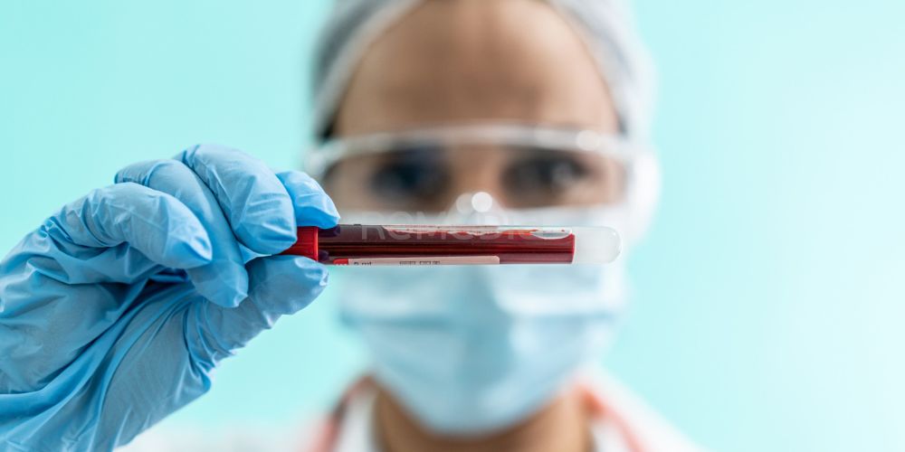 Iptakopan nově hrazen pro léčbu paroxysmální noční hemoglobinurie