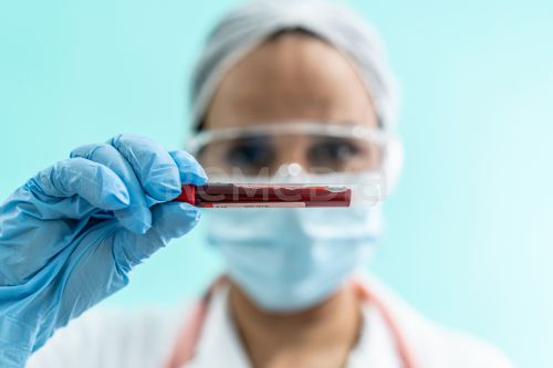 Iptakopan nově hrazen pro léčbu paroxysmální noční hemoglobinurie