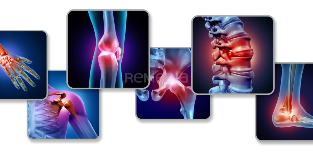 Nové aspekty terapie axiálních spondyloartritid bimekizumabem